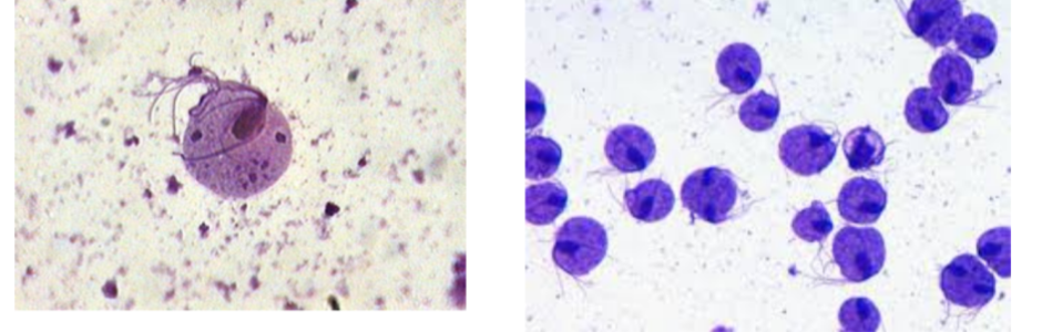 <p><strong><em>Trichomonas vaginalis —</em></strong></p><ul><li><p><span>Describe the shape of&nbsp;</span><strong><em>Trichomonas vaginalis</em></strong></p></li><li><p>How is it sexually transmitted?</p></li><li><p>What <strong>phylum </strong>does it belong to?</p></li><li><p>What is it’s <strong>method of motility</strong>?</p></li><li><p>What <strong>disease </strong>does it cause?&nbsp;</p></li></ul><p></p><p></p>