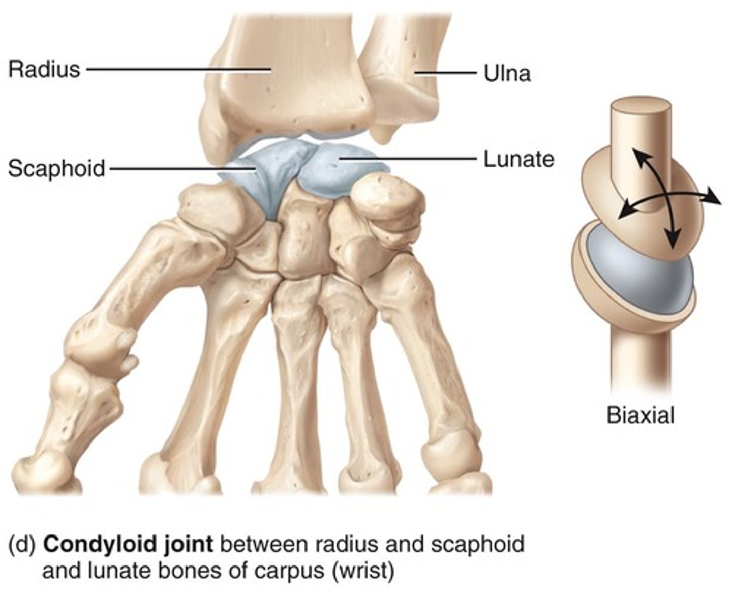 <p>An inflammation of one or more joints, causing pain and stiffness.</p>