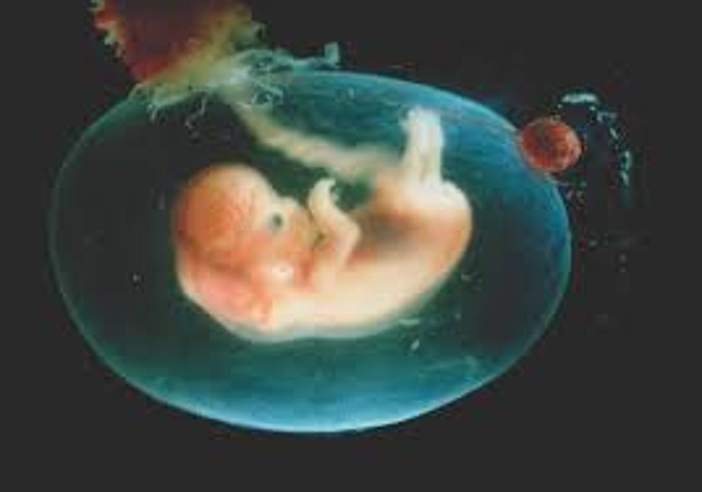 <p>- 1 L is expected at birth</p><p>- Is clear</p><p>- Made up of fluid from the mothers blood and fetal urine</p>