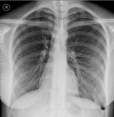<p>What is this pathology?</p>
