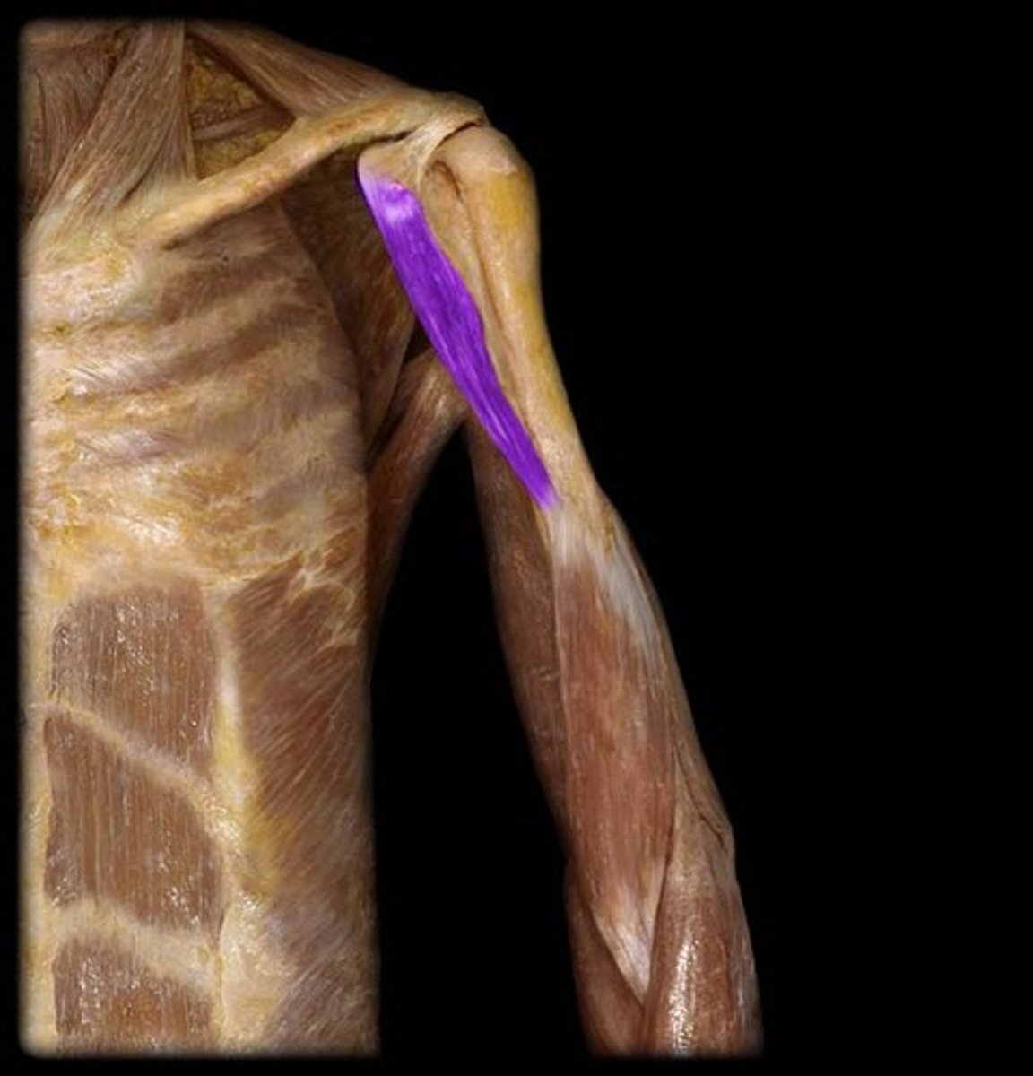 <p>-Flexes and adducts the arm</p><p>-Musculocutaneous n. (C5 - C7)</p><p>-Pierced by the musculocutaneous n. and located in the superomedial part of arm</p>