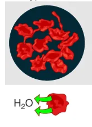 <p>A solution that has a <strong><em><u>higher</u></em></strong> concentration of solutes than a cell</p><ul><li><p>Cells in this type of solution will shrivel as water leaves the cell via osmosis</p></li><li><p>Cell shrinks</p></li></ul><p></p>