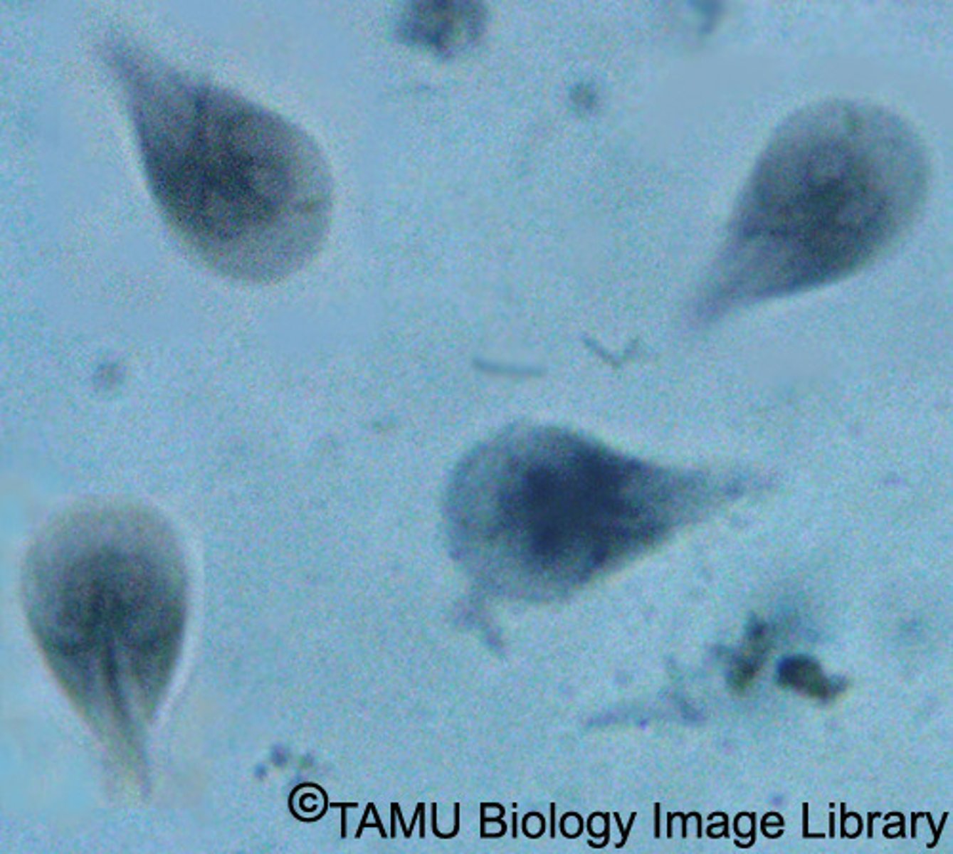 <p>some members have an "excavated" groove on one side of the cell body, distinctive twin nuclei</p><p>examples: trypanosoma (found in blood), giardia (found in feces contaminated water)</p>
