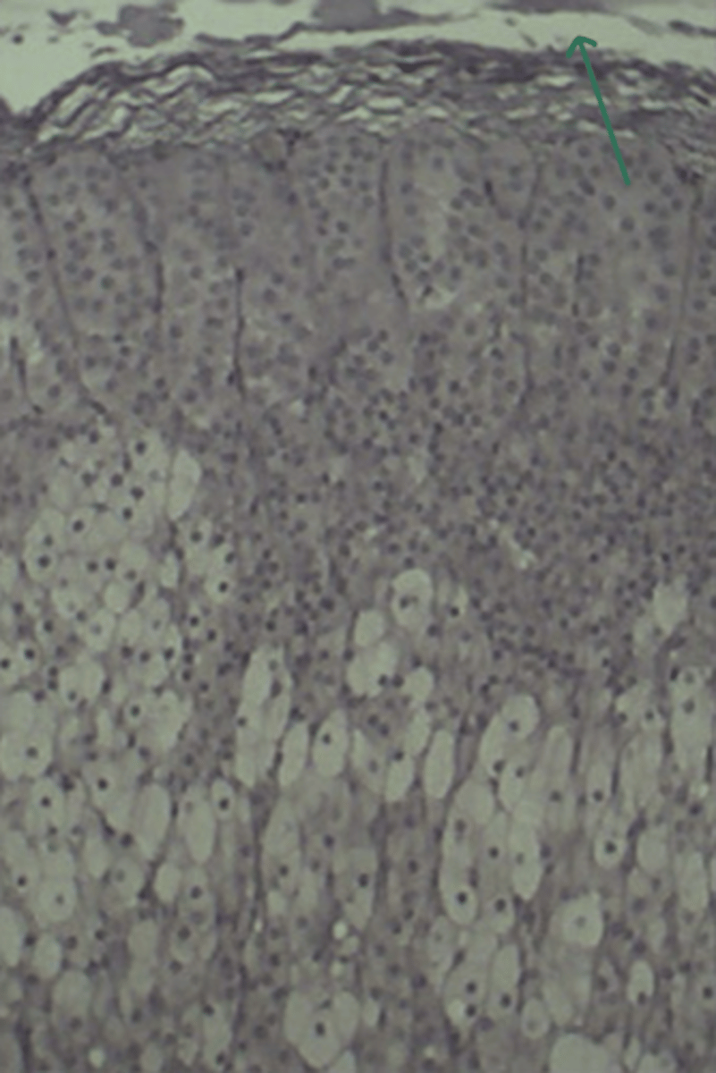 <p>gland and structure</p>