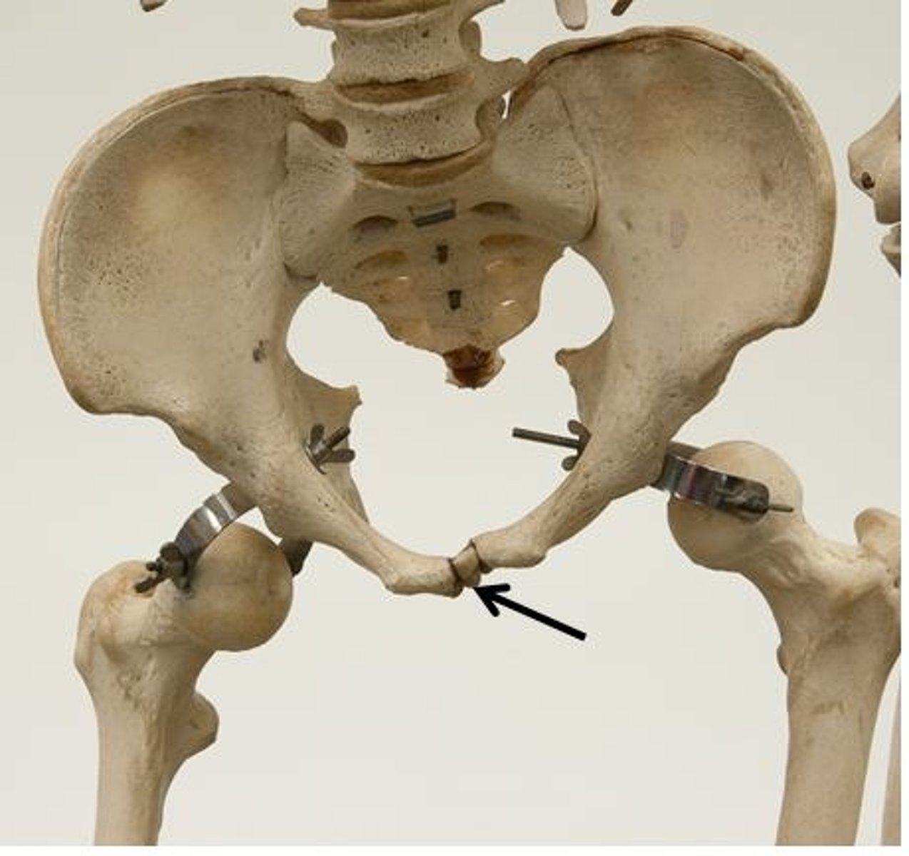 <p>Identify the joint.</p>