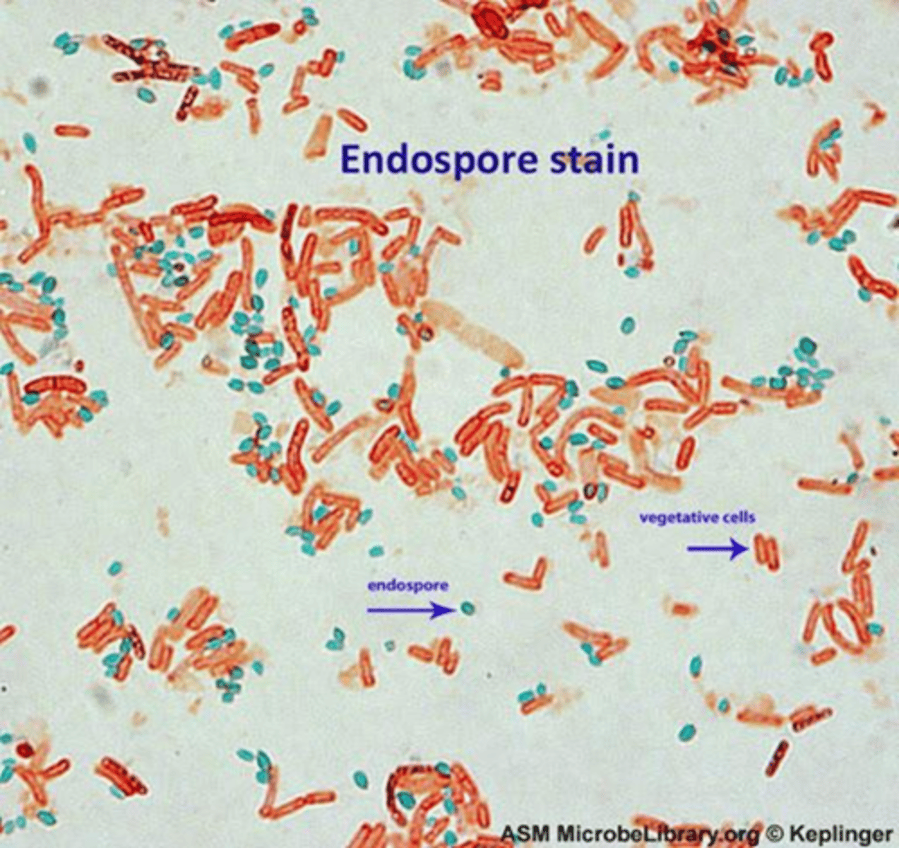 Endospore, Acid Fast, & Capsule Staining Flashcards | Knowt