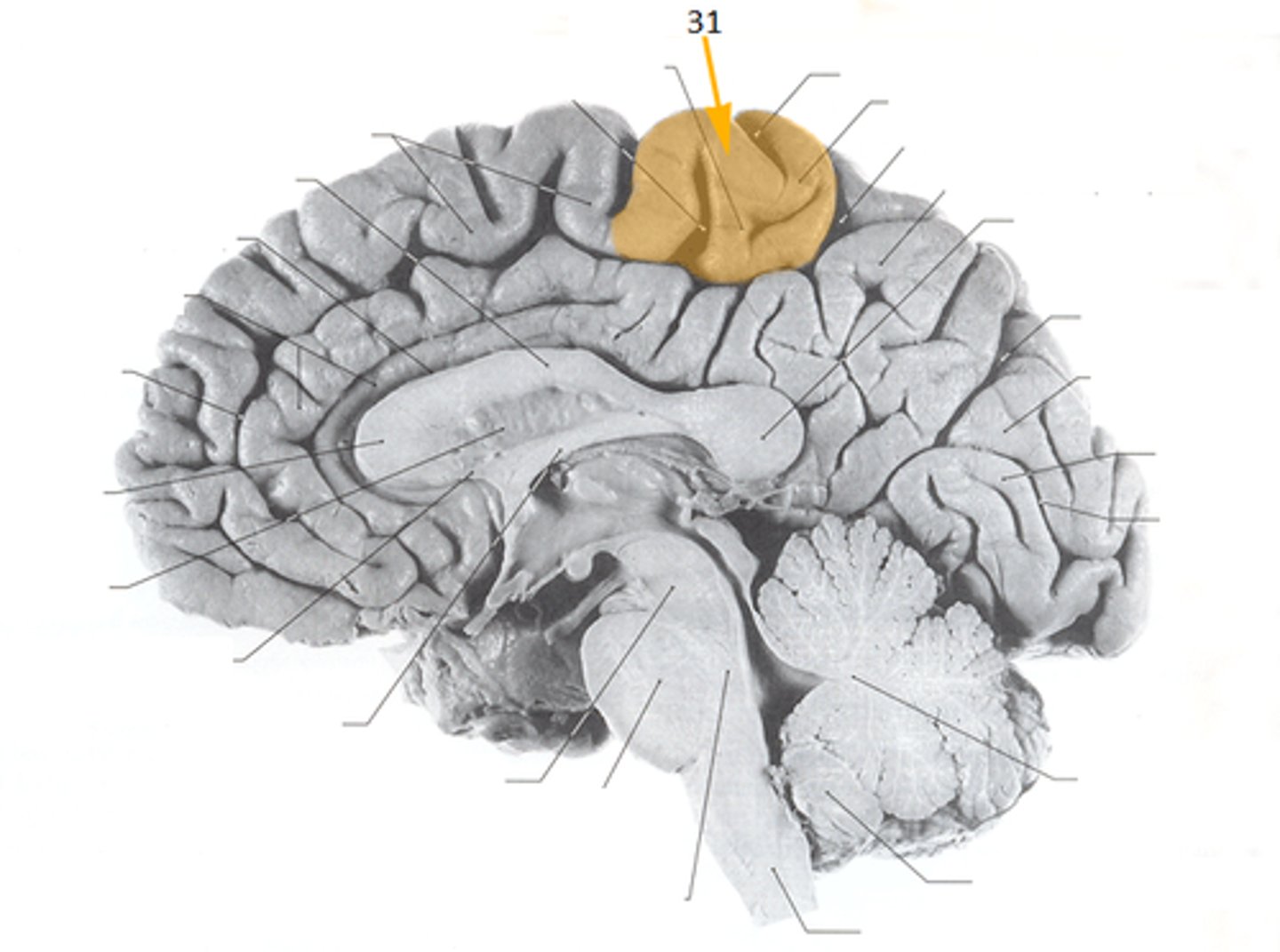 <p>union of precentral and postcentral gyri of frontal and parietal lobes</p>