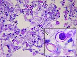 <p>Identify this fungi</p>