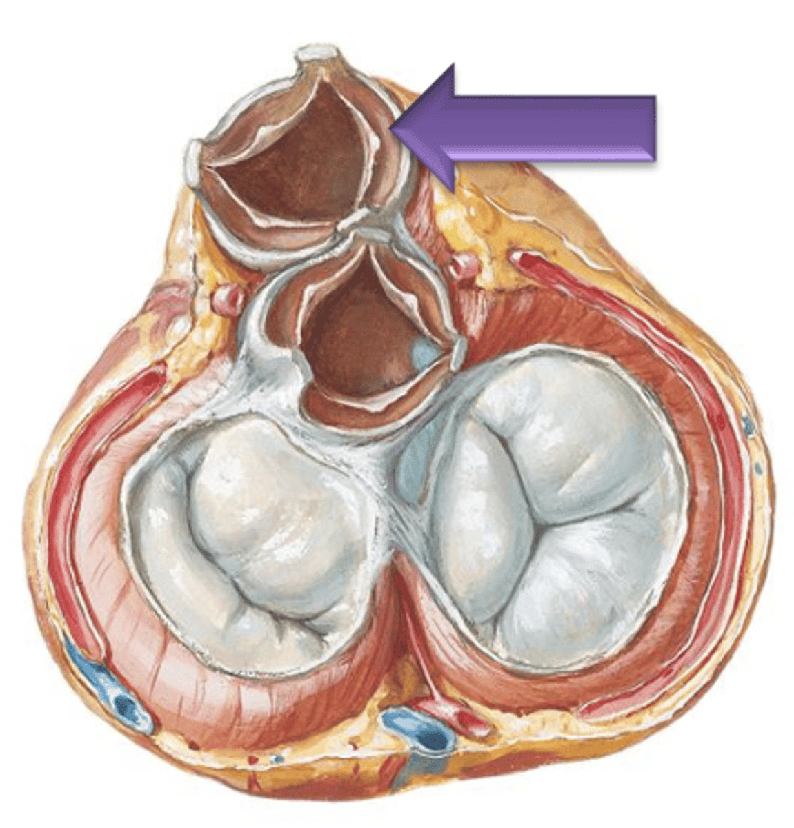 <p>Narrow thin crescent area extending from each side of the nodule on the cusp.</p>