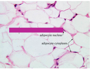 <p>Ribbon-like cytoplasm, Large &apos;empty&apos; space in the middle of the cell. Function is to insulate, store energy, and protect. Found throughout the body (Its fat dumbass)</p>