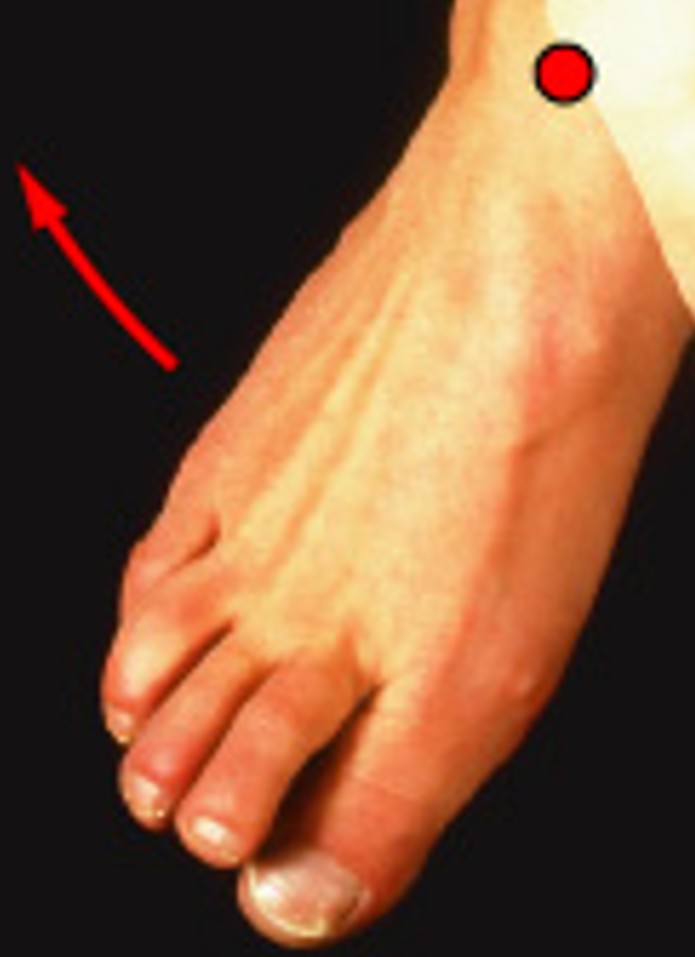 <p>Which special movement is:</p><ul><li><p>Twists sole of foot laterally (outward)</p></li></ul><p></p>