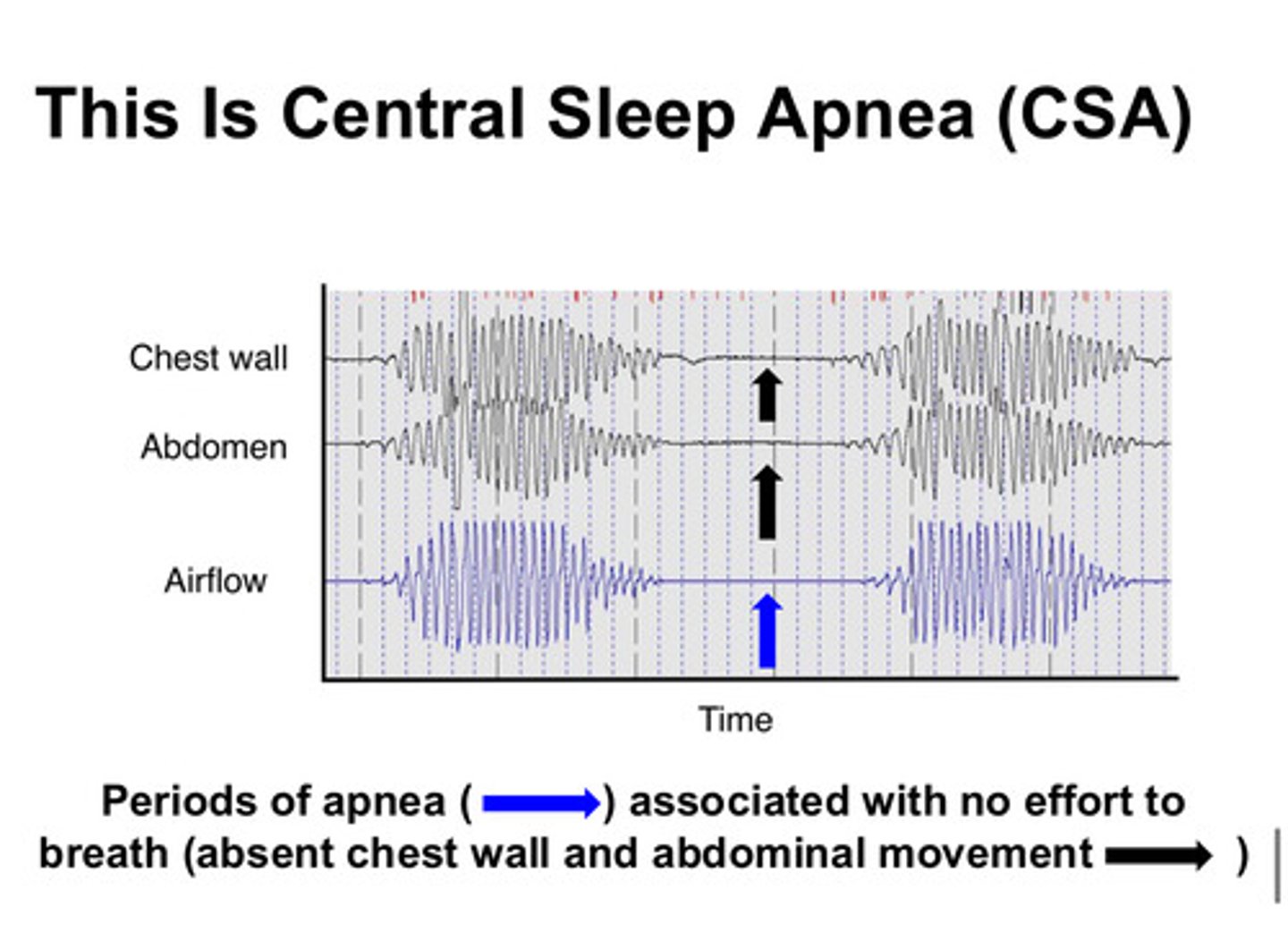 <p>in CSA, there is a problem with the ventilatory control itself. the chemoreceptors either do not detect changes in PaCO2 appropriately or do not communicate to the control center appropriately. people have NO chest wall/abdominal movement or breathing efforts during periods of apnea</p>