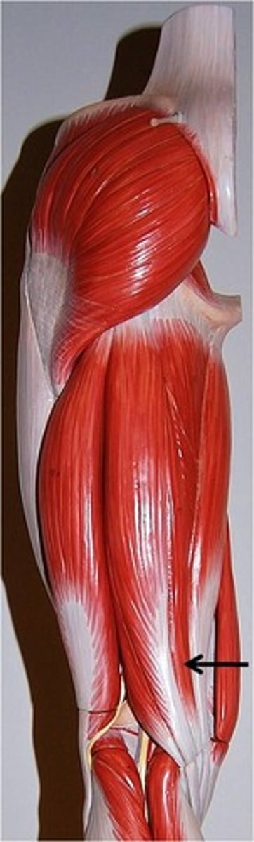 <p>Flexes leg at the knee and extends thigh at the hip; belongs to the hamstring group</p>