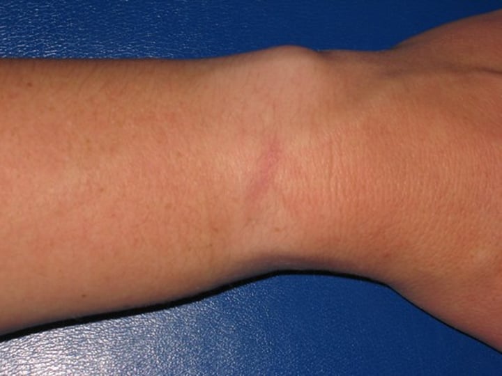 <p>wrist</p>