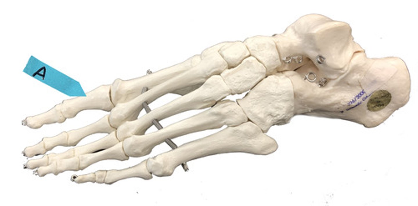 <p>Identify the bone (be specific).</p>
