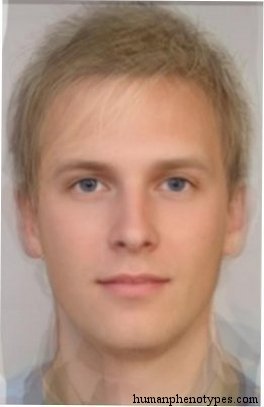 <p>Identify this Phenotype</p>