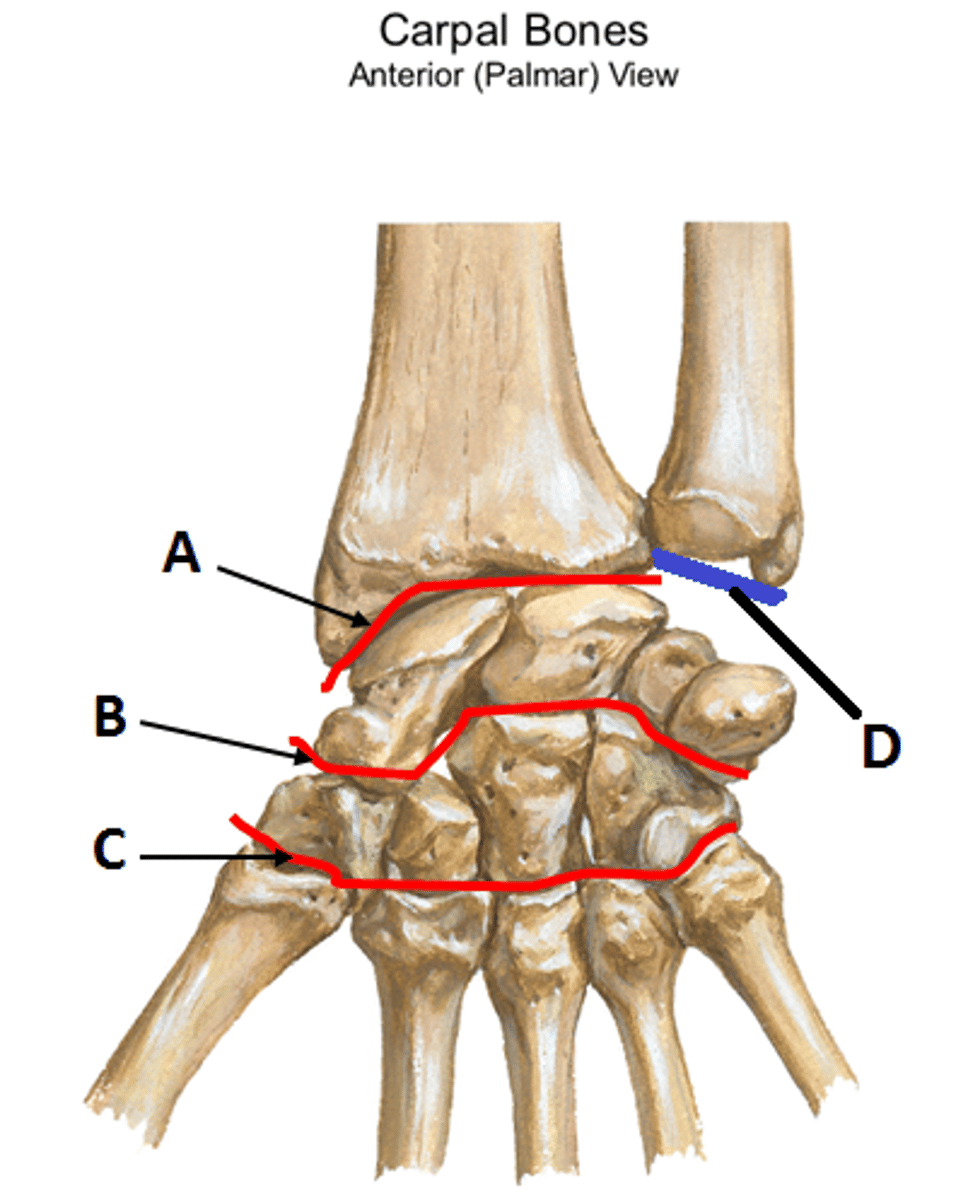 <p>B</p>