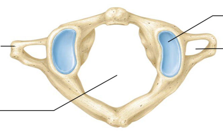 <ul><li><p>No vertebrae body </p></li><li><p>No spinous process</p></li><li><p>Still contains transverse foramen </p></li><li><p>Allows us to shake out head yes</p></li></ul><p></p>