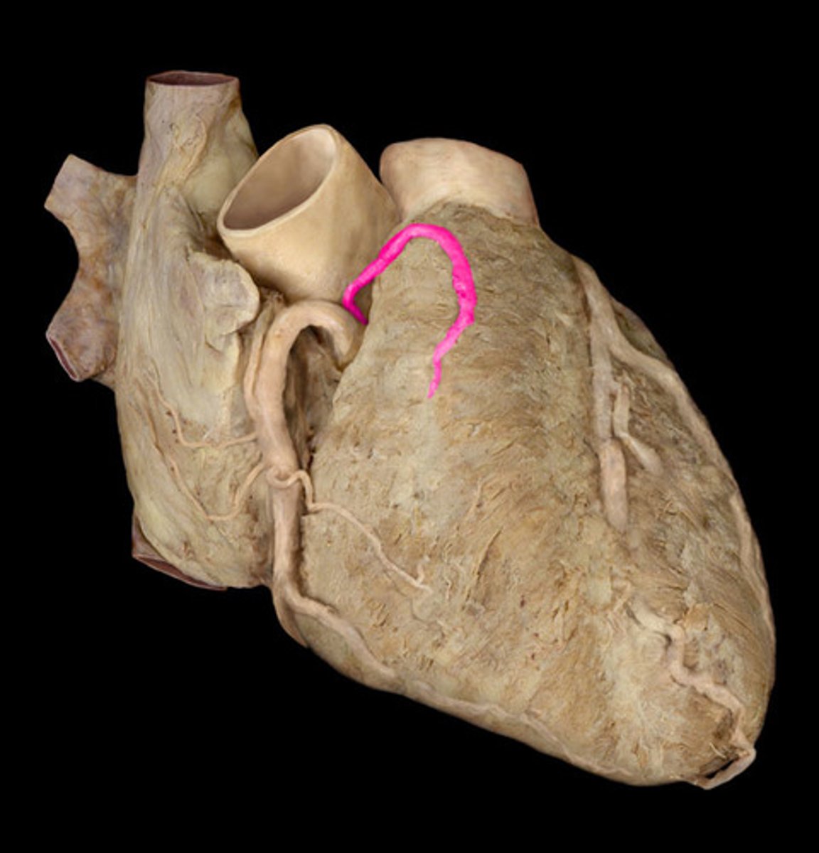<p>right coronary artery branch</p>