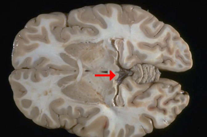 <p>Label this brain structure</p>