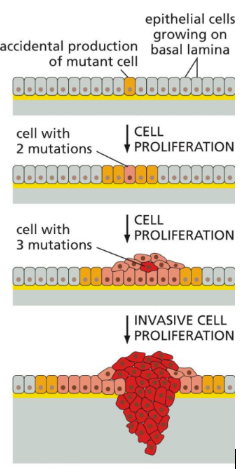 <p><span>Tumors: comprised of genetically identical cells and are clonal in nature&nbsp;</span></p><ul><li><p class="Paragraph SCXW164125487 BCX0" style="text-align: left"><span>Single aberrant cell starts it all&nbsp;</span></p></li></ul><ul><li><p class="Paragraph SCXW164125487 BCX0" style="text-align: left"><span>Alterations in cellular DNA accumulate over time in succeeding generations of daughter cells (clonal expression)&nbsp;</span></p></li></ul><ul><li><p class="Paragraph SCXW164125487 BCX0" style="text-align: left"><span>Daughter cells with several mutations replace the cells previously comprising the tumor&nbsp;</span></p></li></ul><ul><li><p class="Paragraph SCXW164125487 BCX0" style="text-align: left"><span>Induce angiogenesis&nbsp;</span></p></li></ul><p></p>