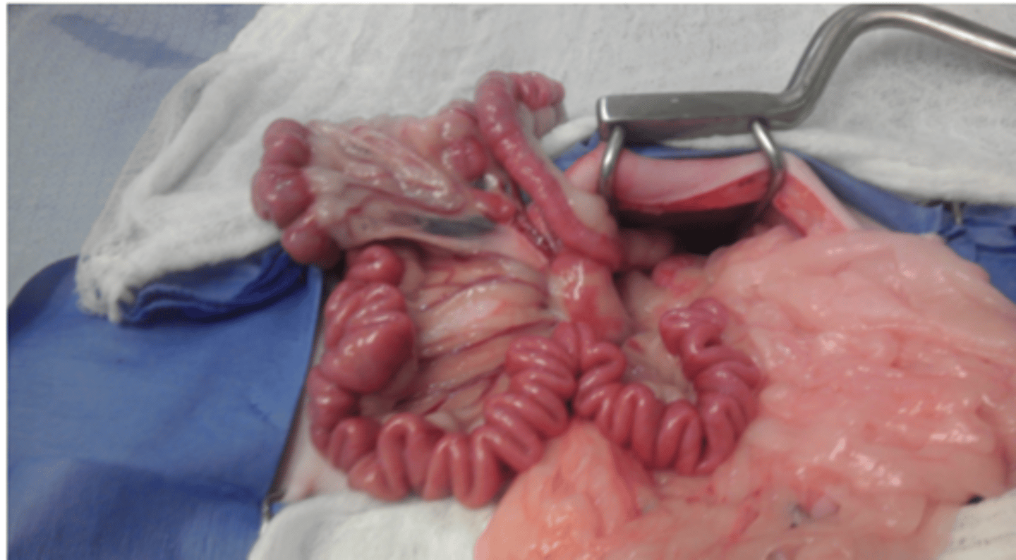 <p>Which condition would cause the bowel to appear plicated</p>