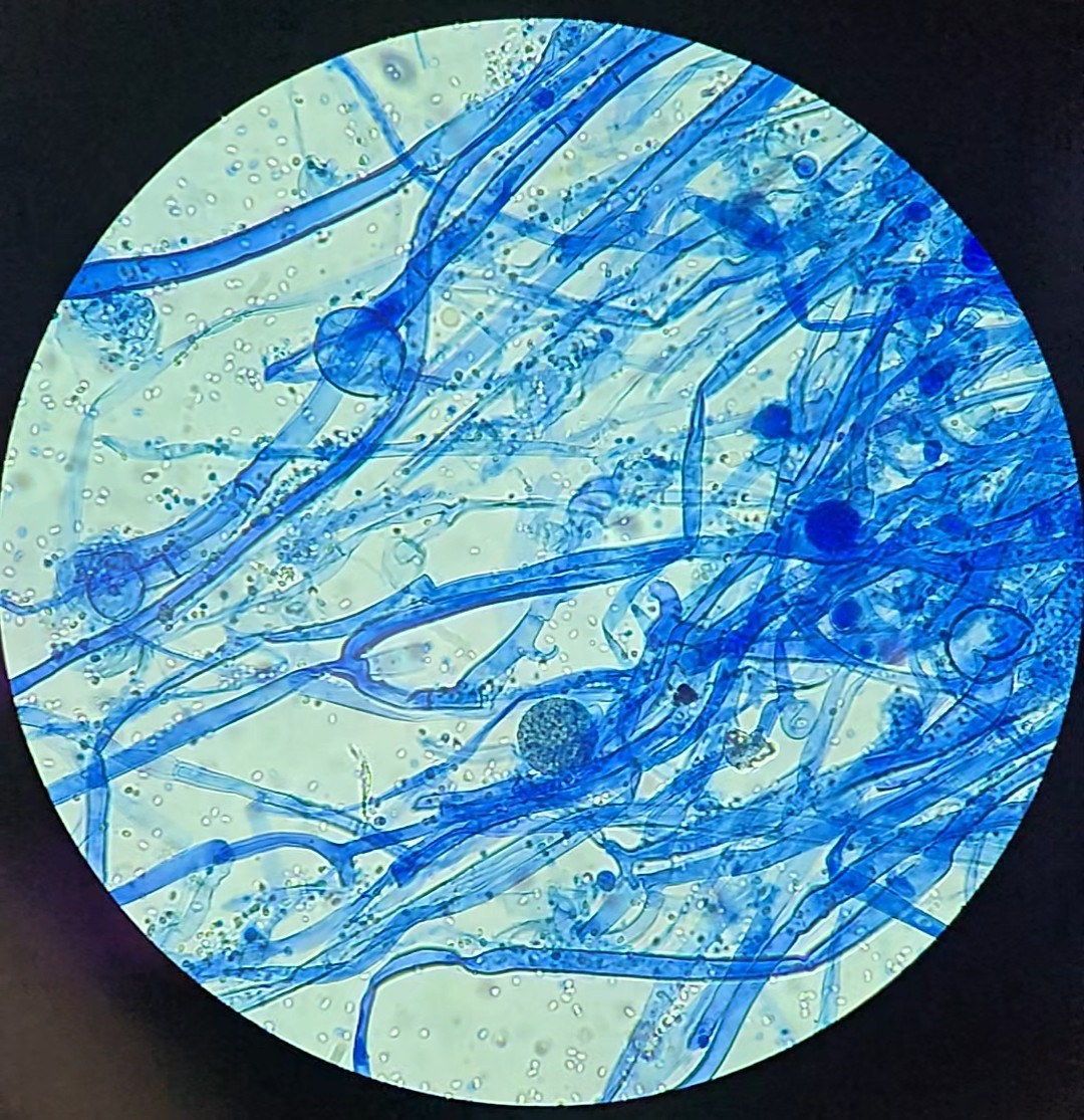 <p>Identify this fungus</p>