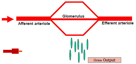 <p>GFR usually maintained by factors such as cardiac output, SNS tone, blood pressure, vascular volume, etc</p><p>Reduction in any of these drivers will lead to reduced GFR and hence urine production</p><ul><li><p>A feedback mechanism that keeps renal blood flow (RBF) and GFR constant despite changes in arterial blood pressure.</p></li><li><p>As RBF increases, GFR increases, leading to an increase in NaCl delivery to the macula densa.</p></li><li><p>a feedback loop through the macula densa to the juxtaglomerular cells of the afferent arteriole results in increased vascular tone, decreased renal blood flow and a decrease in GFR.</p></li><li><p>NaCl to the macula densa then decreases leading to relaxation of the afferent arteriole (increasing glomerular hydrostatic pressure) and increases renin release from juxtaglomerular cells of afferent and efferent arterioles</p></li><li><p>renin increases angiotensin I, then converted to angiotensin II which constrict efferent arteriole increasing hydrostatic pressure returning GFR to normal</p></li></ul><p>The kidneys have inbuilt physiological defense measures to counteract reduced inflow using Prostaglandins and Angiotensin II</p><p>In conditions of stress to the kidneys (eg CKD, DM, HTN, CCF) these mechanisms become increasingly important to maintain GFR.</p>