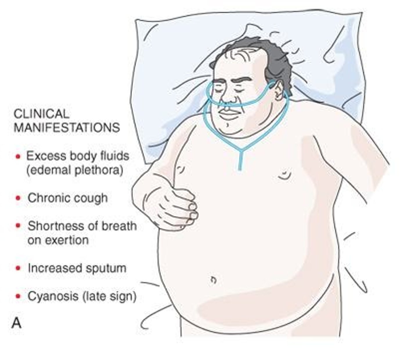 <p>Wheezing, chest tightness, dyspnea, cough, and increased sputum production.</p>