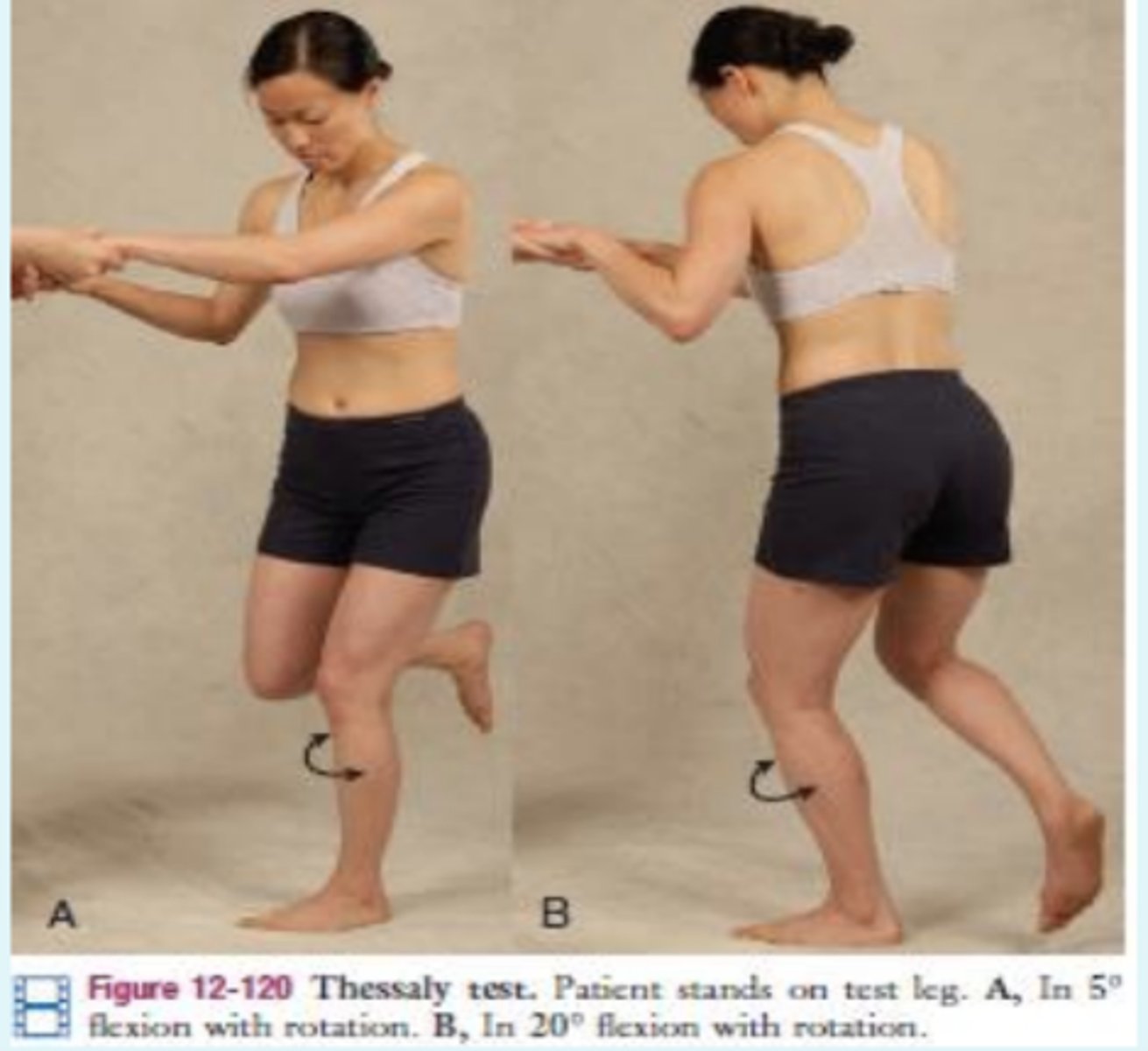 <p>- meniscal</p><p>(+): pt experiences medial or lateral joint line discomfort. also sense of locking or catching the knee</p>