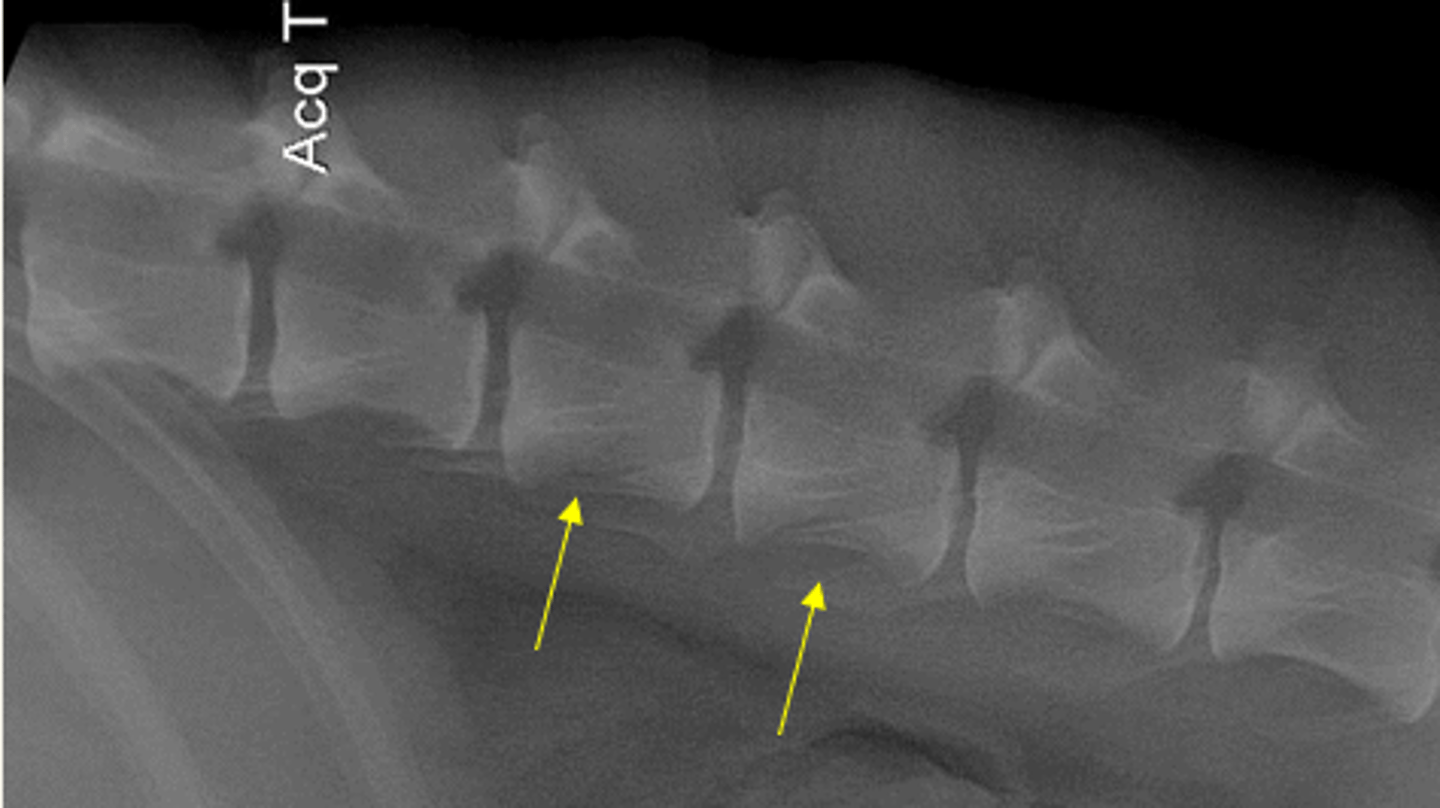 <p>L3 and L4 since this is where the diaphragmatic crura originate</p>