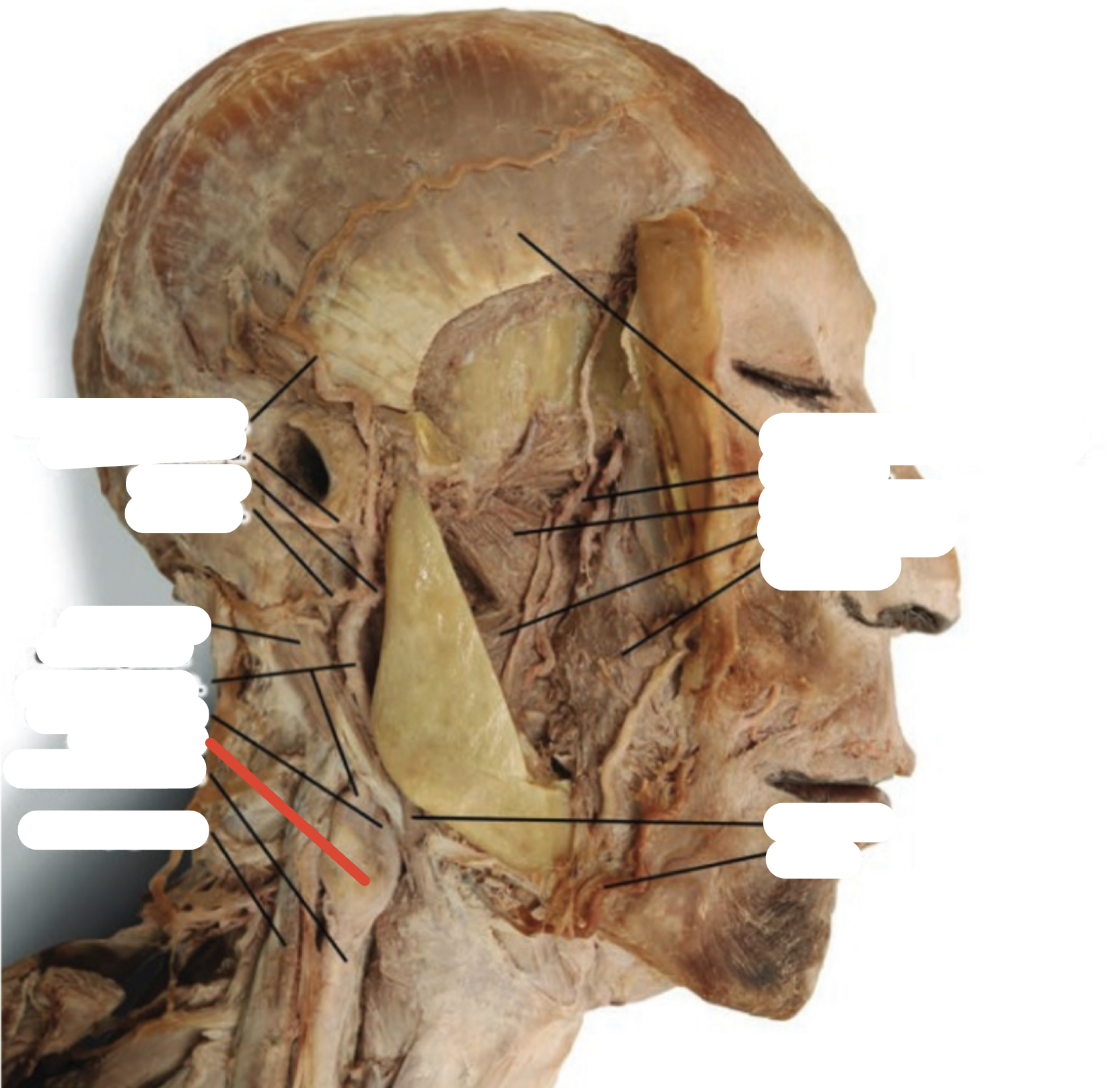 Identify the structure (red line)