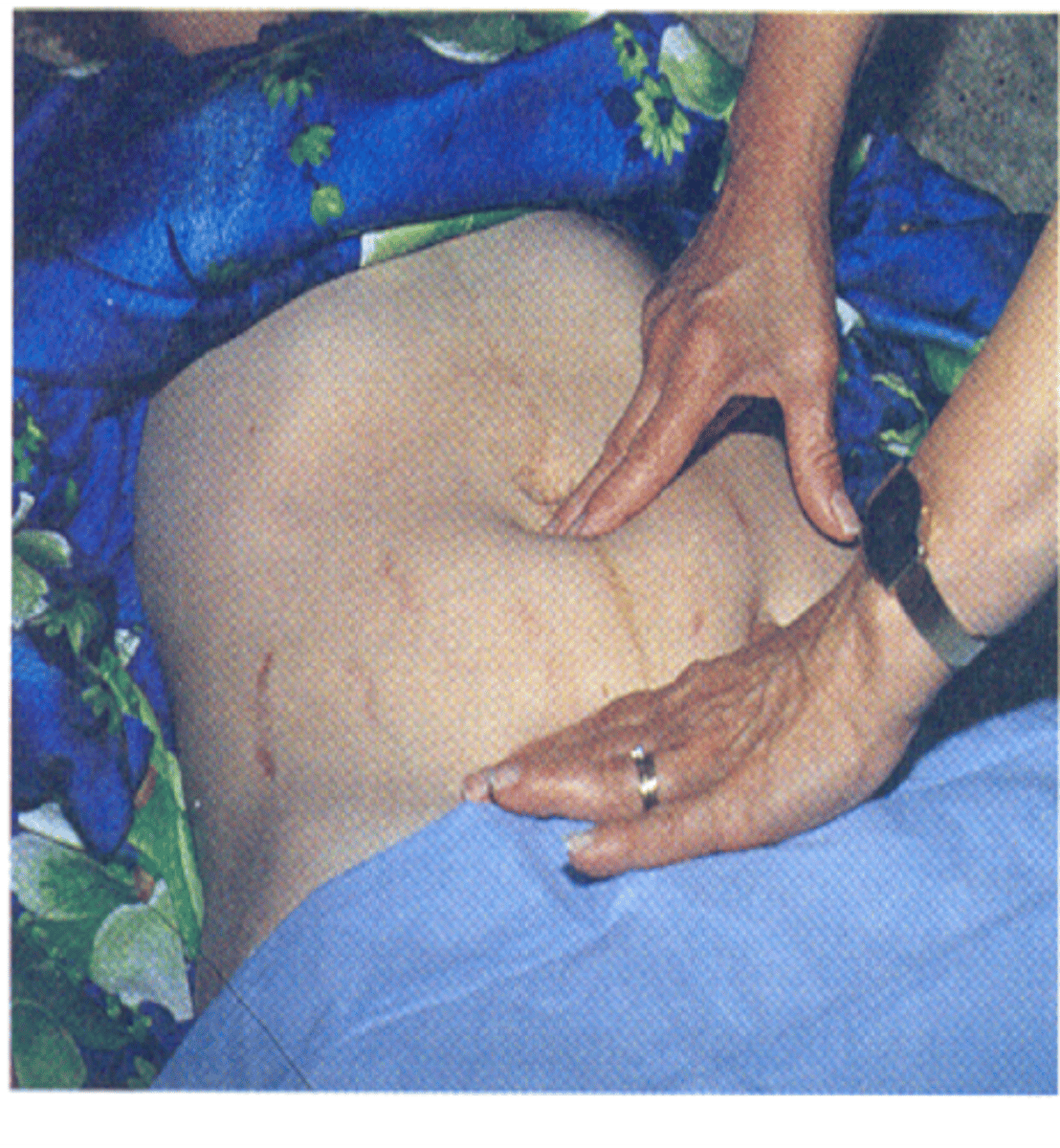 <p>the patient. It is purely subjective.</p><p>Teach patient how to palpate with one hand over the fundus with the pads of the fingers</p>