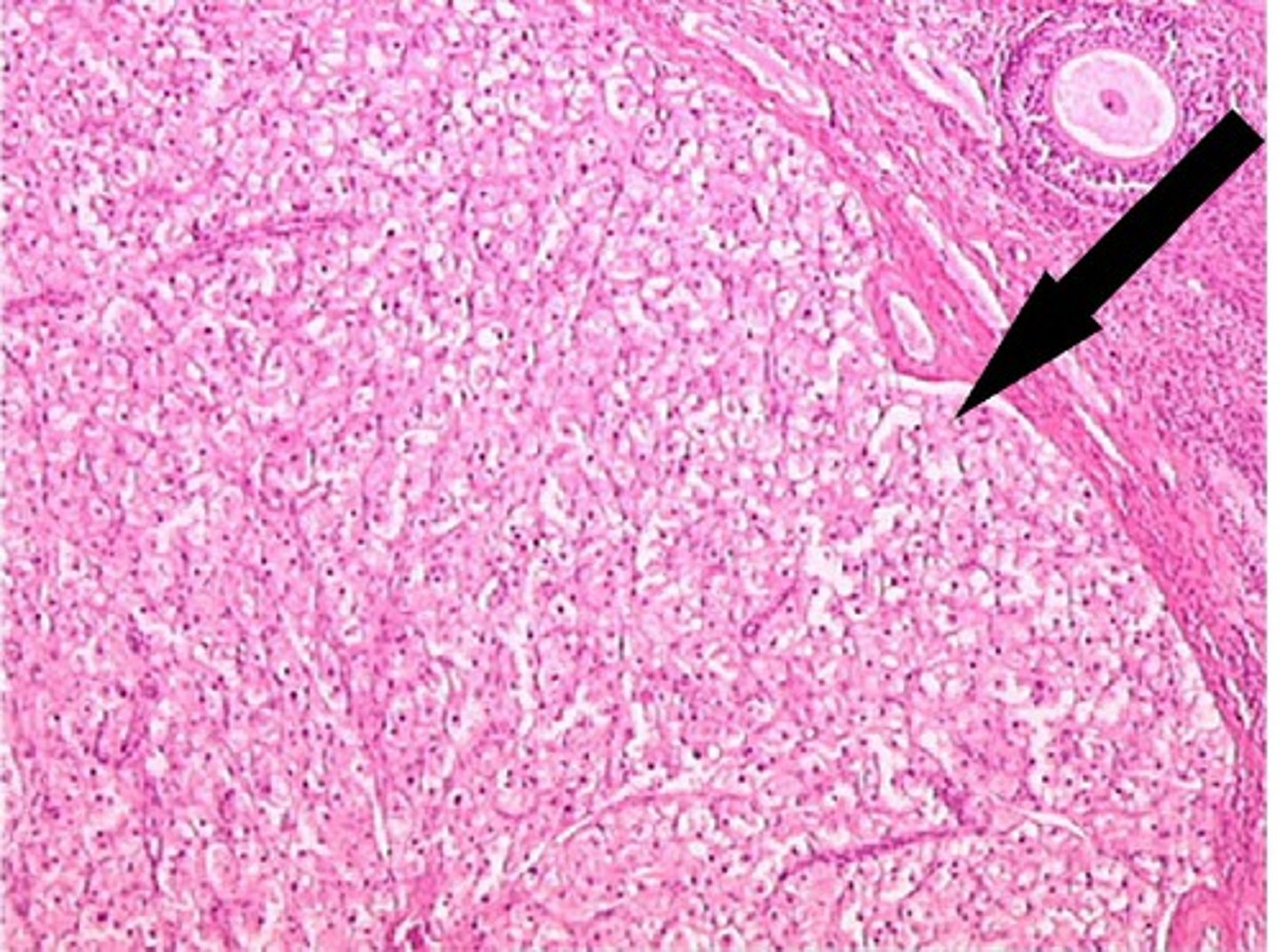 <p>A. Label B. Hormone made there</p>