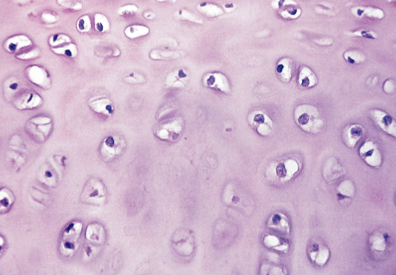 <p>-<strong>clear and glassy looking</strong></p><p><strong>-function → reduces friction at joints & keeps air passages open</strong></p>