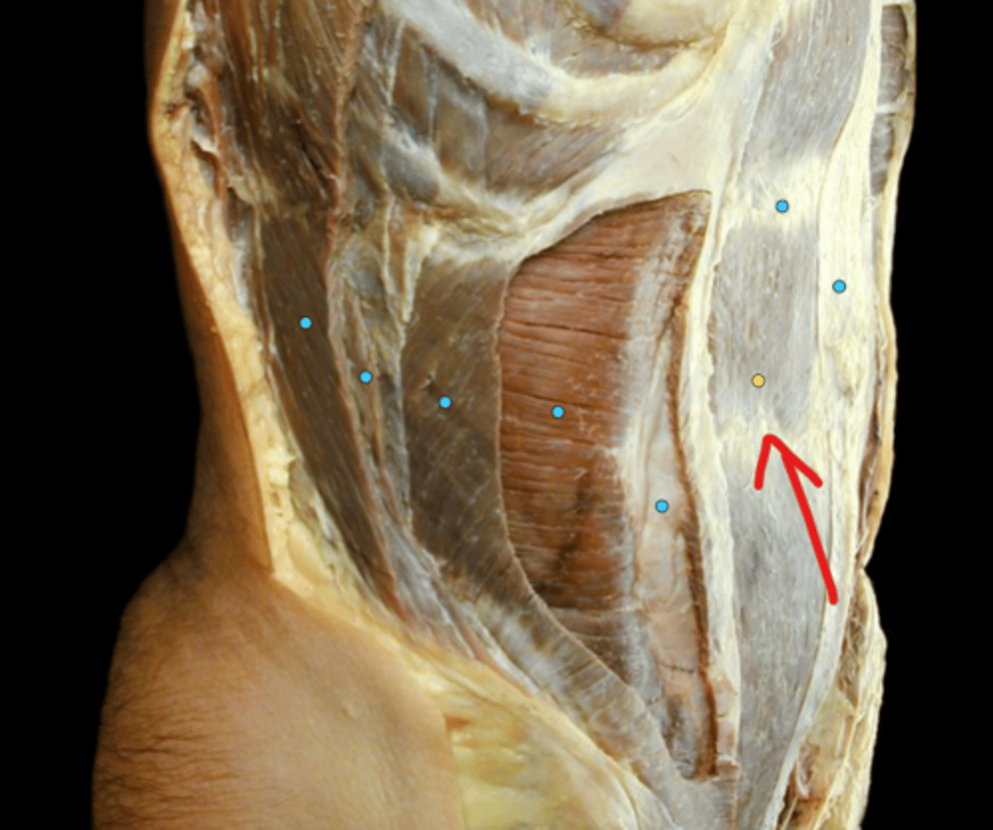 knowt flashcard image
