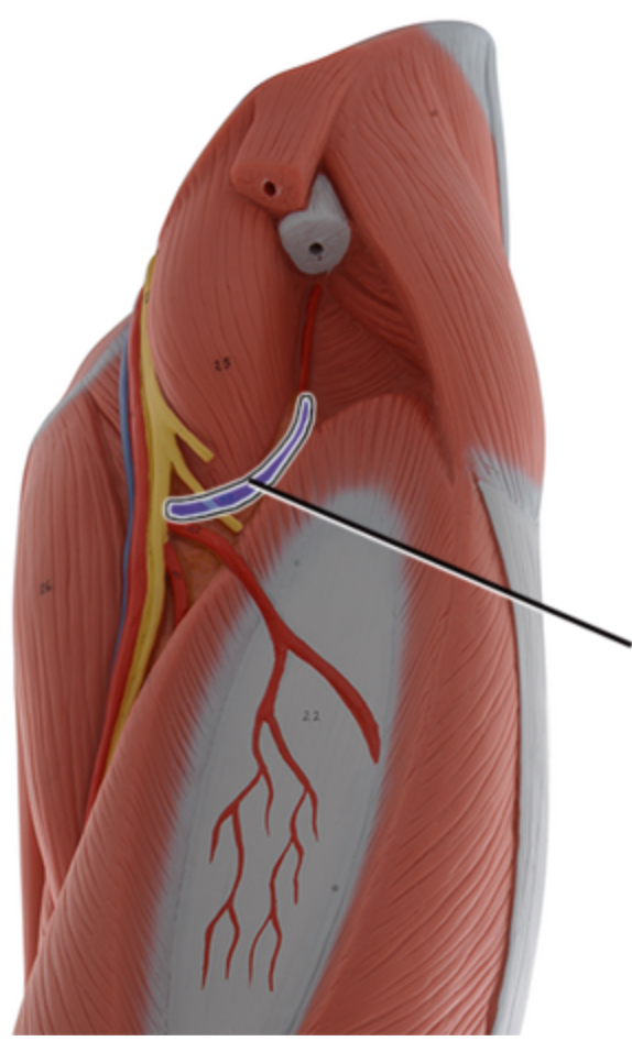 <p>Name this artery.</p>