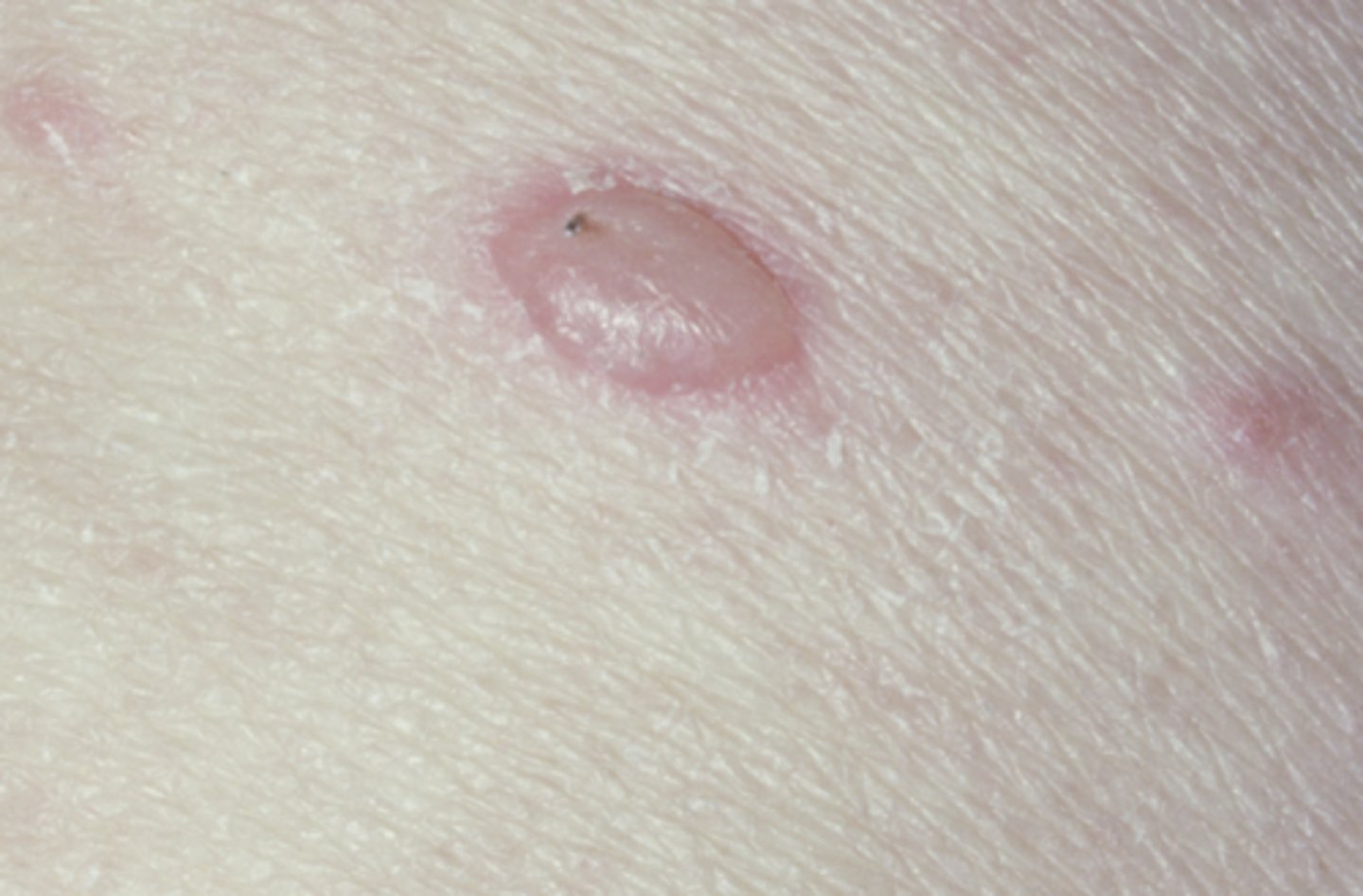 <p>What condition?</p>