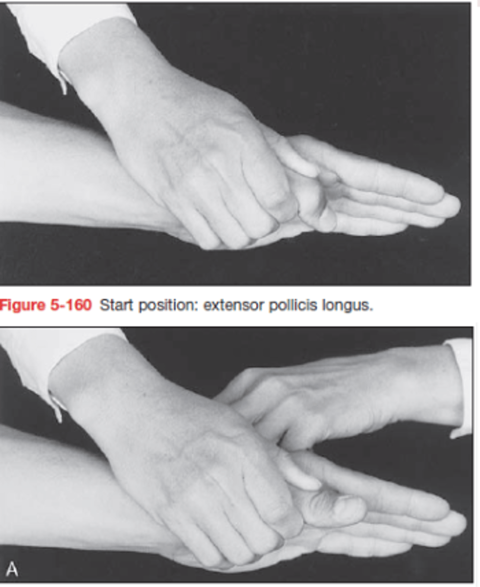 <p>KH: pro-sup középhelyzet, IP flexio</p><p>Rögzítés: proximalis phalanxig</p><p>Nyújtsa az IP-t!</p><p>Ellenállás: körömpercre</p>