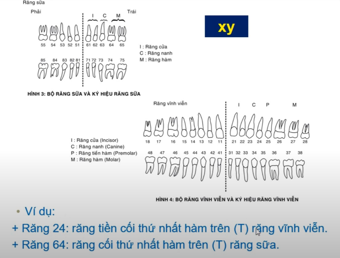 <p>Răng 53 là răng gì ?</p><p>Răng 42 là răng gì ? </p>