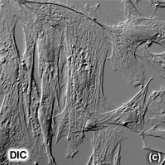 <p>Modified direct light microscopy.</p><p>Capable of viewing living specimens by using the phase changes of visible light and optical lenses to magnify an image.</p><p>A special objective lenses can be affixed to the microscope to observe the phase changes that light undergoes when it passes through a material with differential refractive indexes, allowing us to observe the cell in 3 dimensions with the Z axis defined by the refractive index differences.</p><p>No haloes with DIC</p>