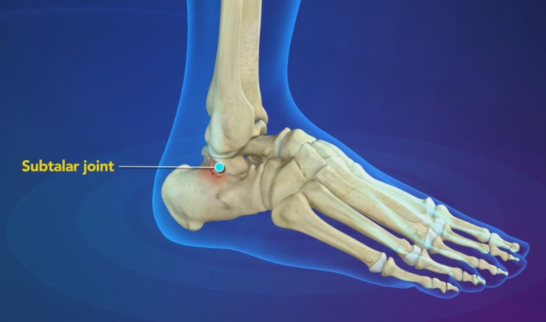 <p>Subtalar Joint (sub-tah-ler)</p>