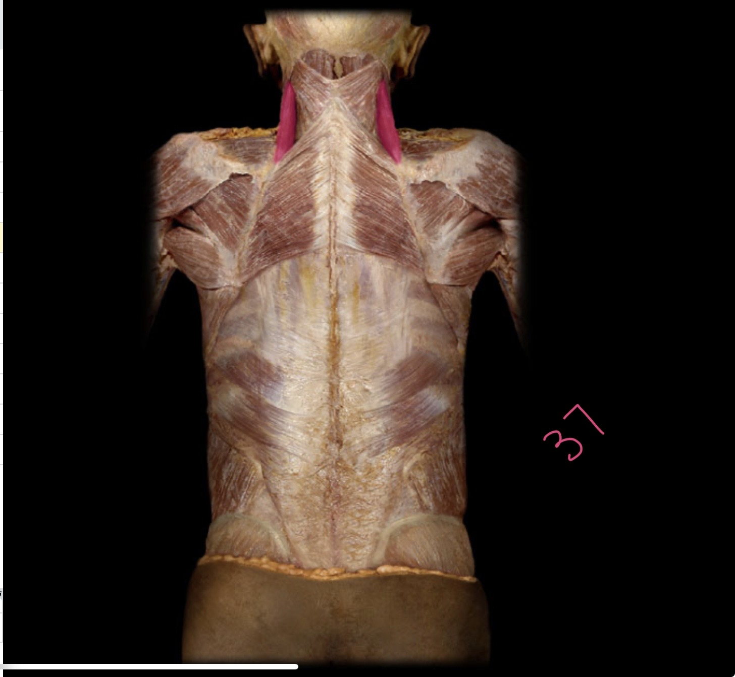 <p>Levator scapulae</p>