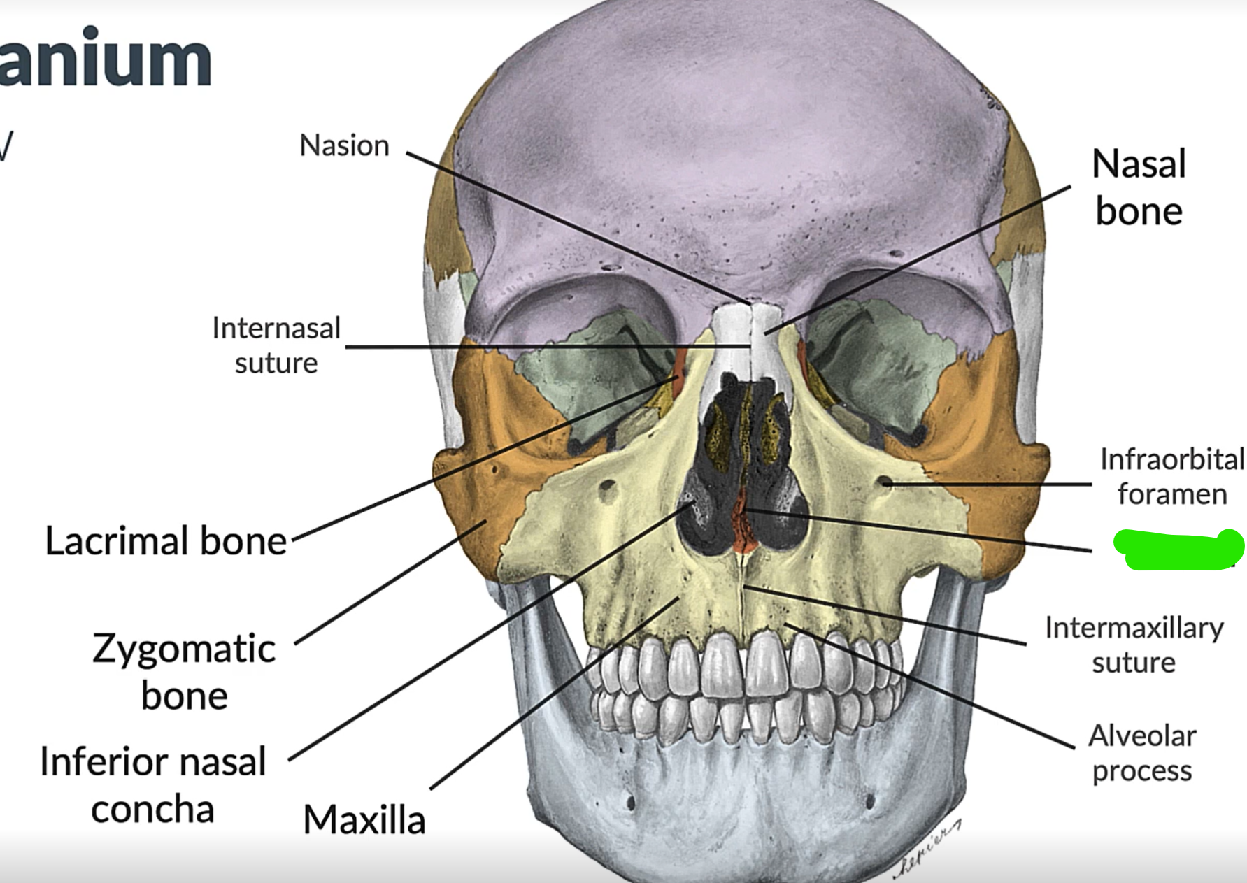 term image