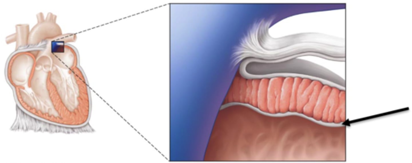 <p>inner lining of the heart</p>