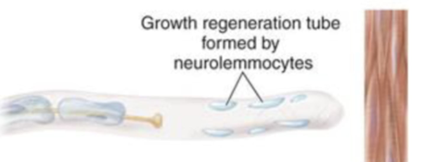 <p>what is step 2 of 4 in peripheral nerve regeneration?</p>