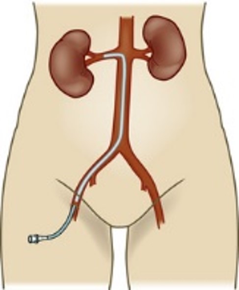 <p><span>•</span><strong><span>Review the description, purpose and nursing responsibilities</span></strong></p><p><span>•Urinalysis</span></p><p><span>•Creatinine clearance: no calculation; no values; just purpose and nursing responsibilities</span></p><p><span>•Composite urine collection</span></p><p><span>•Urine clean catch</span></p><p><span>•Concentration test (aka: specific gravity)</span></p><p><span>•Residual urine</span></p><p><span>•Protein dipstick</span></p><p><span>•Quantative protein</span></p><p><span>•BUN, Creatinine, K+, Sodium, Calcium, Phos, Sodium Bicarb</span></p><p><span>•Renal biopsy</span></p><p><span>•Cystoscopy</span></p><p><span>•MRI</span></p><p><span>•Renal Ultrasound</span></p><p><span>•CT</span></p><p><span>•KUB</span></p><p><span>•Renal Arteriogram&nbsp;</span></p>