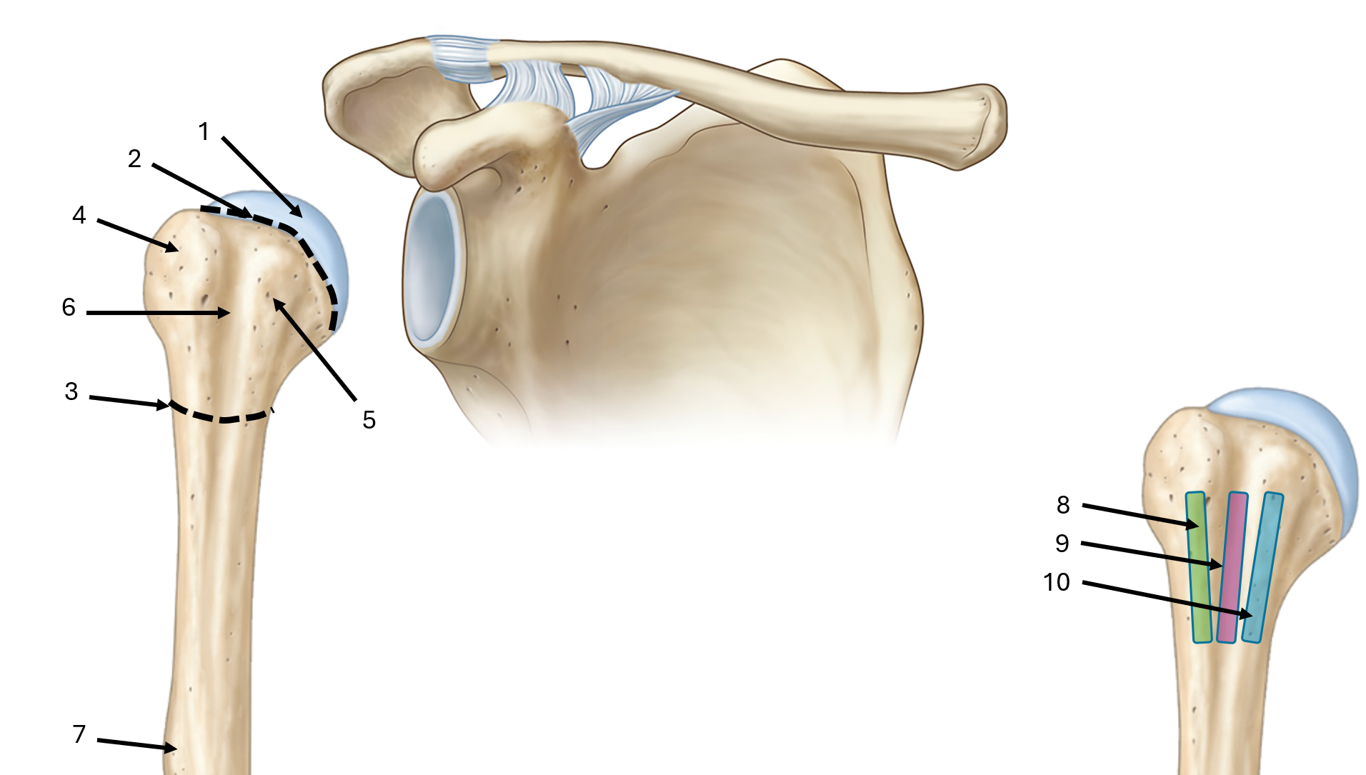 <p>what is label #3</p>