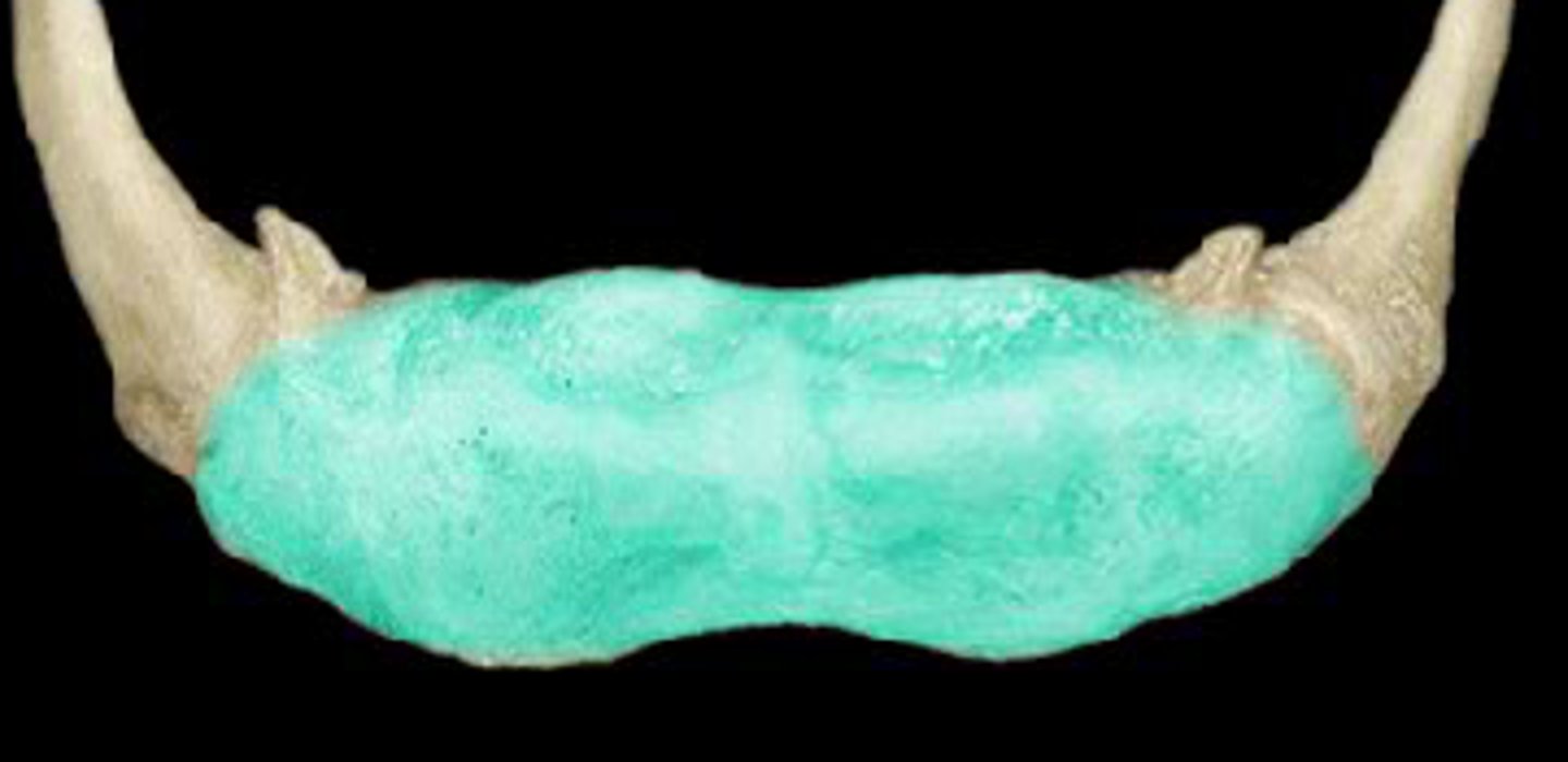 <p>Identify the structure</p>