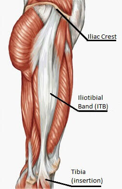 <p>Long band along the lateral thigh; stabilizes the knee during walking and running; easily palpable along the lateral thigh.</p>